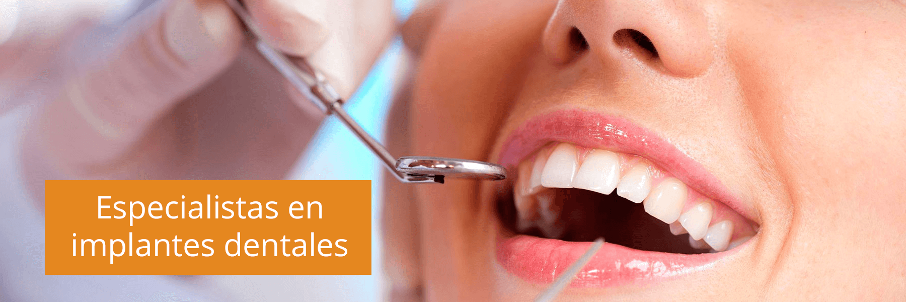 Beneficios de los Implantes dentales | Clínica Dental Beltrán