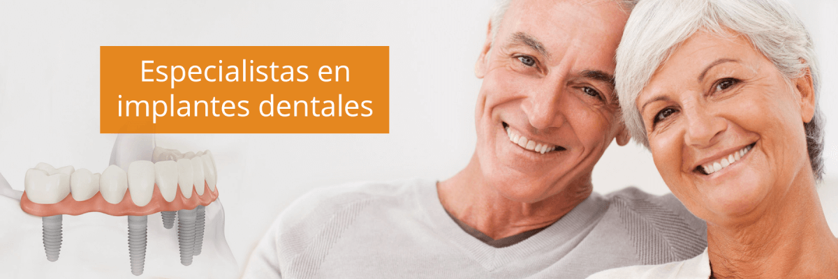 Implantes dentales valencia