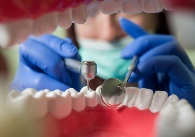 endodoncia