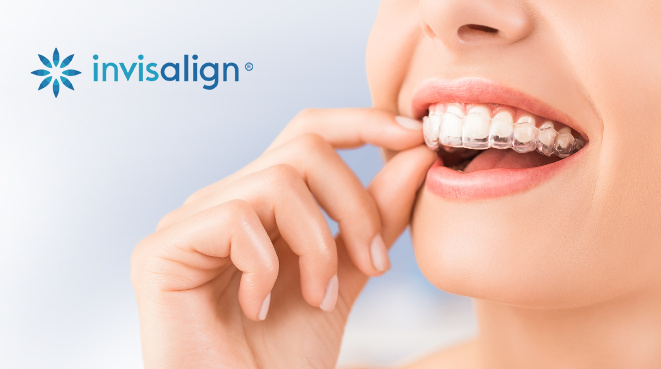 invisalign