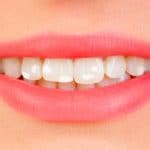 manchas blancas dientes